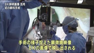 日本实施全球首例借8K超高清显微镜白内障手术