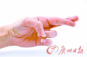 手指交叉或有助缓解痛苦 双臂交叉也能减少疼痛