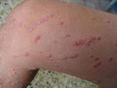 重庆朝天门医院