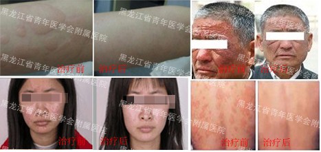 北京津门中医院皮肤科