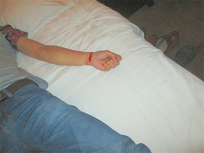 男子割腕拍照发彩信给朋友 民警赶到宾馆救一命