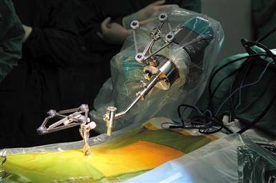 脊柱手术进入精准时代机器人帮助医生完成手术路径规划