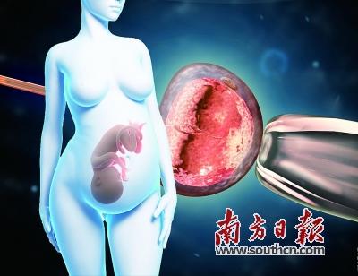 试管婴儿为何种植失败?炎症会让“种子”难发芽