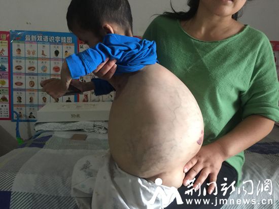 病童_副本